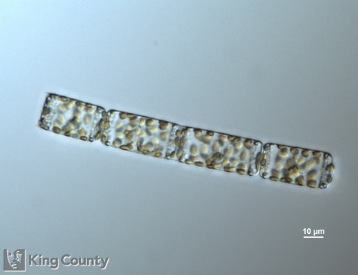 Photo of Cerataulina pelagica